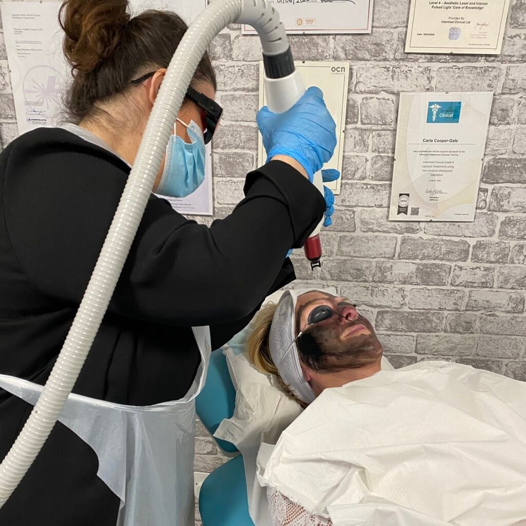 Carbon laser peel: a practitioner in laser safety eyewear, mask, apron and gloves treats a client wearing a carbon mask and eye shields