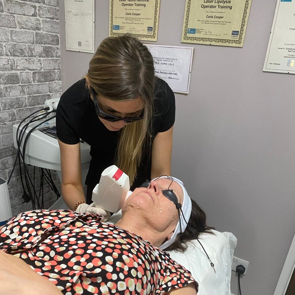 Pigmentation treatment: a practitioner in laser safety eyewear and gloves treats the jawline of a client who wears eye shields