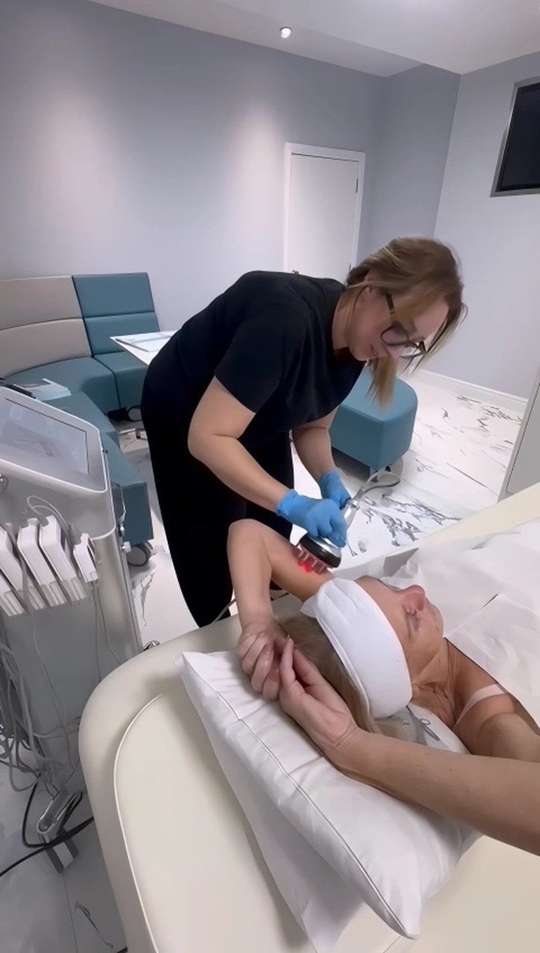 Radio Frequency Skin Tightening