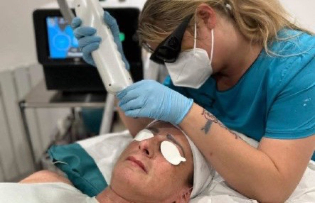 Semi-Permanent Makeup Removal
