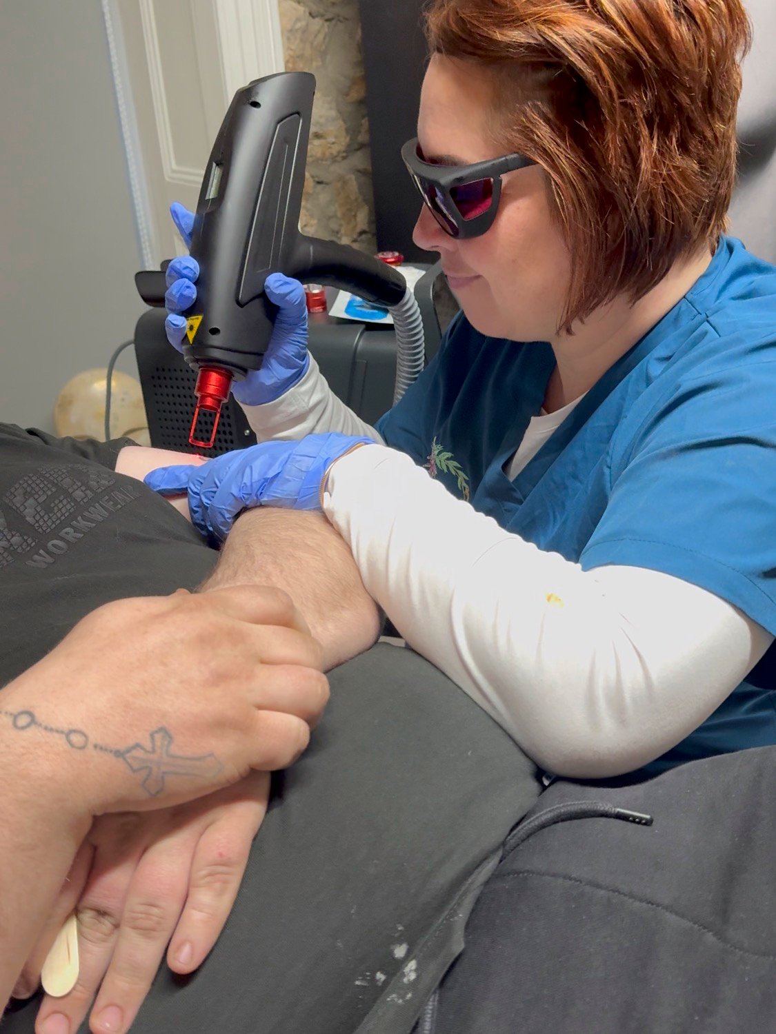 Laser Tattoo Removal